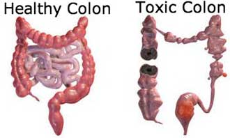 colon-cleaning